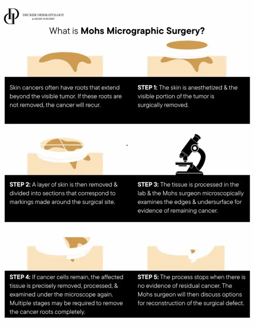 Diagram showing six steps of how the pupil reacts to light changes.