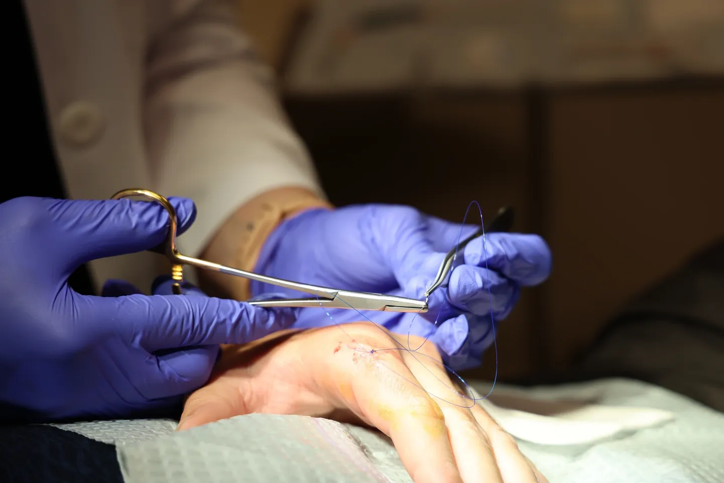 Surgeon performing precise hand surgery with medical tools.